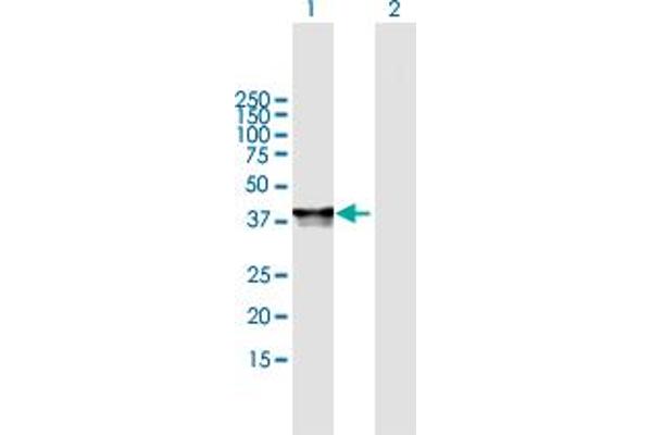 PHF20L1 antibody  (AA 1-285)