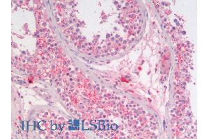 ABIN6391386 (5µg/ml) staining of paraffin embedded Human Testis. (SGTA antibody  (AA 84-97))