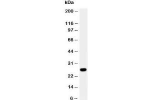 Western blot testing of Aquaporin 8 antibody and A431 cell lysate.