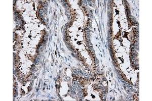Immunohistochemical staining of paraffin-embedded pancreas tissue using anti-RC200180 mouse monoclonal antibody. (KCTD5 antibody)