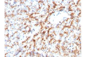 Immunohistochemistry (IHC) image for anti-Cathepsin D (CTSD) (AA 104-250) antibody (ABIN6939215)