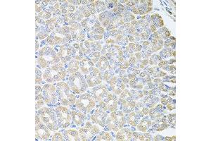 Immunohistochemistry of paraffin-embedded mouse stomach using SKAP2 antibody at dilution of 1:100 (x40 lens). (SKAP2 antibody)
