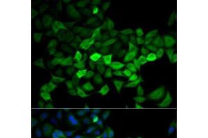 Immunofluorescence analysis of HeLa cells using UBE2C Polyclonal Antibody (UBE2C antibody)