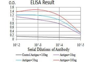 Black line: Control Antigen (100 ng);Purple line: Antigen (10ng); Blue line: Antigen (50 ng); Red line:Antigen (100 ng) (Calretinin antibody  (AA 172-271))