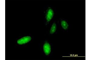 Immunofluorescence of monoclonal antibody to HOXC10 on HeLa cell.