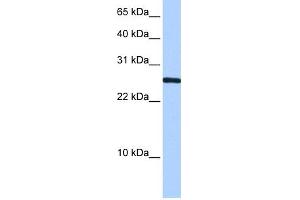 WB Suggested Anti-CIRBP Antibody Titration:  0. (CIRBP antibody  (N-Term))