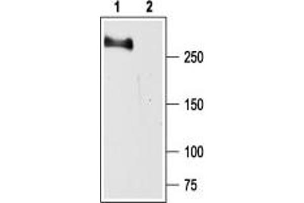 SCN2A Antikörper  (Intracellular)
