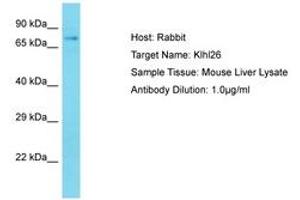 Image no. 1 for anti-Kelch-Like 26 (KLHL26) (AA 51-100) antibody (ABIN6750241) (KLHL26 antibody  (AA 51-100))