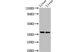 Western Blot Positive WB detected in: Mouse liver tissue, Rat liver tissue All lanes: CCNH antibody at 3 μg/mL Secondary Goat polyclonal to rabbit IgG at 1/50000 dilution Predicted band size: 38 kDa Observed band size: 38 kDa (Cyclin H antibody  (AA 261-319))