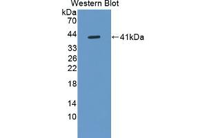 Detection of Recombinant DEFa6, Human using Polyclonal Antibody to Defensin Alpha 6, Paneth Cell Specific (DEFa6) (DEFA6 antibody  (AA 19-99))