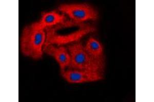 Immunofluorescent analysis of Arylsulfatase D staining in A549 cells. (Arylsulfatase D antibody  (Center))