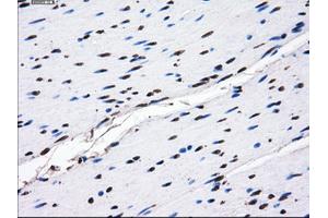 Immunohistochemical staining of paraffin-embedded endometrium tissue using anti-GBE1mouse monoclonal antibody. (GBE1 antibody)
