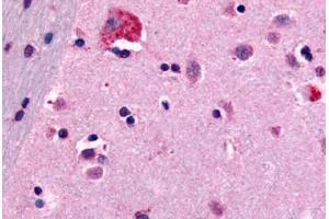 Anti-CNR1 / CB1 antibody  ABIN1048452 IHC staining of human brain, neurons and glia. (CNR1 antibody  (N-Term))