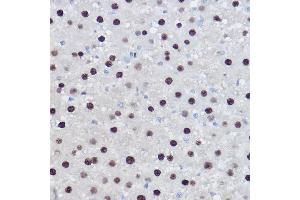 Immunohistochemistry of paraffin-embedded rat liver using EZH2/KMT6 Rabbit pAb (ABIN6133511, ABIN6140395, ABIN6140399 and ABIN6221414) at dilution of 1:100 (40x lens). (EZH2 antibody  (AA 1-250))