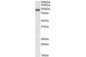 Staining of A431 lysate using PRDM1 antibody at 0. (PRDM1 antibody  (Internal Region))