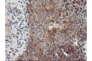 Image no. 5 for anti-Metalloproteinase Inhibitor 2 (TIMP2) antibody (ABIN1501394) (TIMP2 antibody)