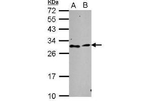 WB Image Sample (30 ug of whole cell lysate) A: NT2D1 B: SK-N-SH 12% SDS PAGE antibody diluted at 1:1000 (TATDN3 antibody  (Center))