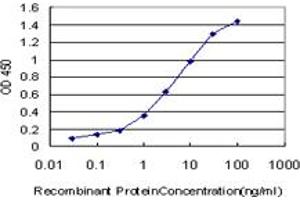 Detection limit for recombinant GST tagged CPS1 is approximately 0. (CPS1 antibody  (AA 1400-1500))