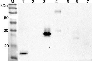 Western blot analysis using anti-ANGPTL4 (CCD) (human), pAb  at 1:2'000 dilution. (ANGPTL4 antibody  (Coiled coil domain))