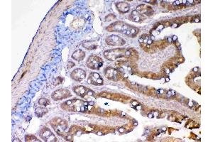IHC analysis of MMP13 using anti-MMP13 antibody .