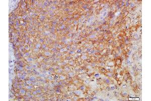 Formalin-fixed and paraffin embedded human endometrium labeled with Anti-FSH/FSHB Polyclonal Antibody, Unconjugated  at 1:200 followed by conjugation to the secondary antibody and DAB staining