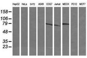 Image no. 5 for anti-Differentially Expressed in FDCP 6 Homolog (DEF6) antibody (ABIN1497809) (DEF6 antibody)