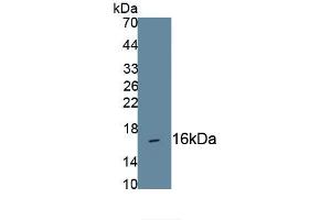 Detection of Recombinant CNP, Human using Monoclonal Antibody to C-Type Natriuretic Peptide (CNP) (NPPC antibody  (AA 33-125))