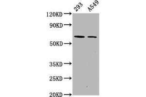 Western Blot Positive WB detected in 293 whole cell lysate 65549 whole cell lysate All lanes Phospho-PRKAA2 antibody at 1. (Recombinant PRKAA2 antibody  (pSer491))
