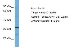 Host: Rabbit Target Name: C12ORF49 Sample Tissue: Human ACHN Whole Cell Antibody Dilution: 1ug/ml (C12orf49 antibody  (N-Term))