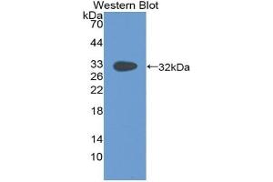Detection of Recombinant Pax, Human using Polyclonal Antibody to Paxillin (PXN) (Paxillin antibody  (AA 201-461))