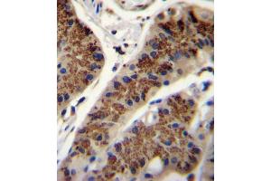 INHBA Antibody (N-term) (ABIN655078 and ABIN2844710) immunohistochemistry analysis in formalin fixed and paraffin embedded human stomach tissue followed by peroxidase conjugation of the secondary antibody and DAB staining. (INHBA antibody  (N-Term))