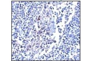Immunohistochemistry (IHC) image for anti-Interleukin 33 (IL33) antibody (ABIN492540) (IL-33 antibody)