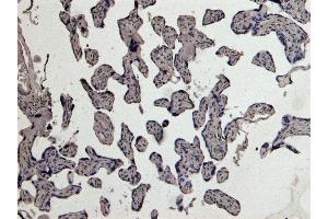 ABIN185470 Negative Control showing staining of paraffin embedded Human Placenta, with no primary antibody.