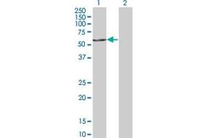 Western Blot analysis of FASTK expression in transfected 293T cell line by FASTK monoclonal antibody (M02), clone 2B7.