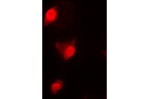 Immunofluorescent analysis of Cyclin B1 staining in K562 cells. (Cyclin B1 antibody  (Center))