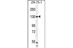 WWC1 Antibody (N-term) (ABIN654697 and ABIN2844390) western blot analysis in ZR-75-1 cell line lysates (35 μg/lane). (WWC1 antibody  (N-Term))