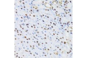 Immunohistochemistry of paraffin-embedded rat kidney using SFN Antibody. (14-3-3 sigma/SFN antibody  (AA 1-248))