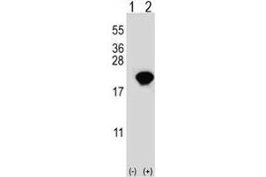 Western blot analysis of PIN1 antibody and 293 cell lysate either nontransfected (Lane 1) or transiently transfected (2) with the PIN1 gene.