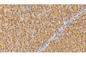 Detection of GHR in Human Liver Tissue using Polyclonal Antibody to Growth Hormone Receptor (GHR) (Growth Hormone Receptor antibody  (AA 315-574))