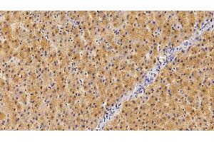 Detection of GHR in Human Liver Tissue using Polyclonal Antibody to Growth Hormone Receptor (GHR) (Growth Hormone Receptor antibody  (AA 315-574))