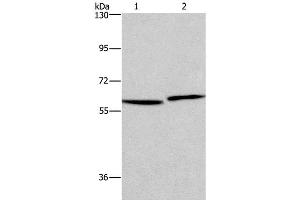 Western Blot analysis of Human testis and prostate tissue using HAS1 Polyclonal Antibody at dilution of 1:350 (HAS1 antibody)