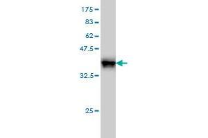 Western Blot detection against Immunogen (37. (GRF2 antibody  (AA 1-110))