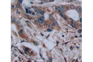 Figure. (BCAR3 antibody  (AA 548-818))