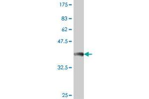 Western Blot detection against Immunogen (38. (PDCD11 antibody  (AA 1-110))