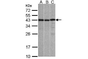 WB Image Sample(30 ug whole cell lysate) A:A431, B:Hep G2 , C:Raji , 12% SDS PAGE antibody diluted at 1:1000