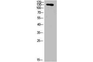 Western Blot analysis of HELA cells using primary antibody diluted at 1:2000(4 °C overnight). (COL19A1 antibody  (AA 161-210))