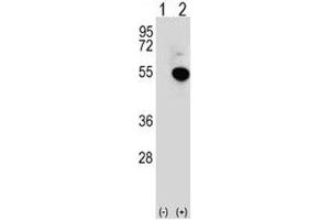Western blot analysis of IRF4 antibody and 293 cell lysate (2 ug/lane) either nontransfected (Lane 1) or transiently transfected (2) with the IRF4 gene.