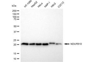 Western blotting analysis using NDUFB10 antibody (ABIN7799546). (NDUFB10 antibody)