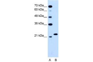 WB Suggested Anti-RAB14  Antibody Titration: 0. (RAB14 antibody  (C-Term))