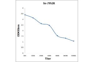 Antigen: 0. (ADCK2 antibody  (AA 545-626))